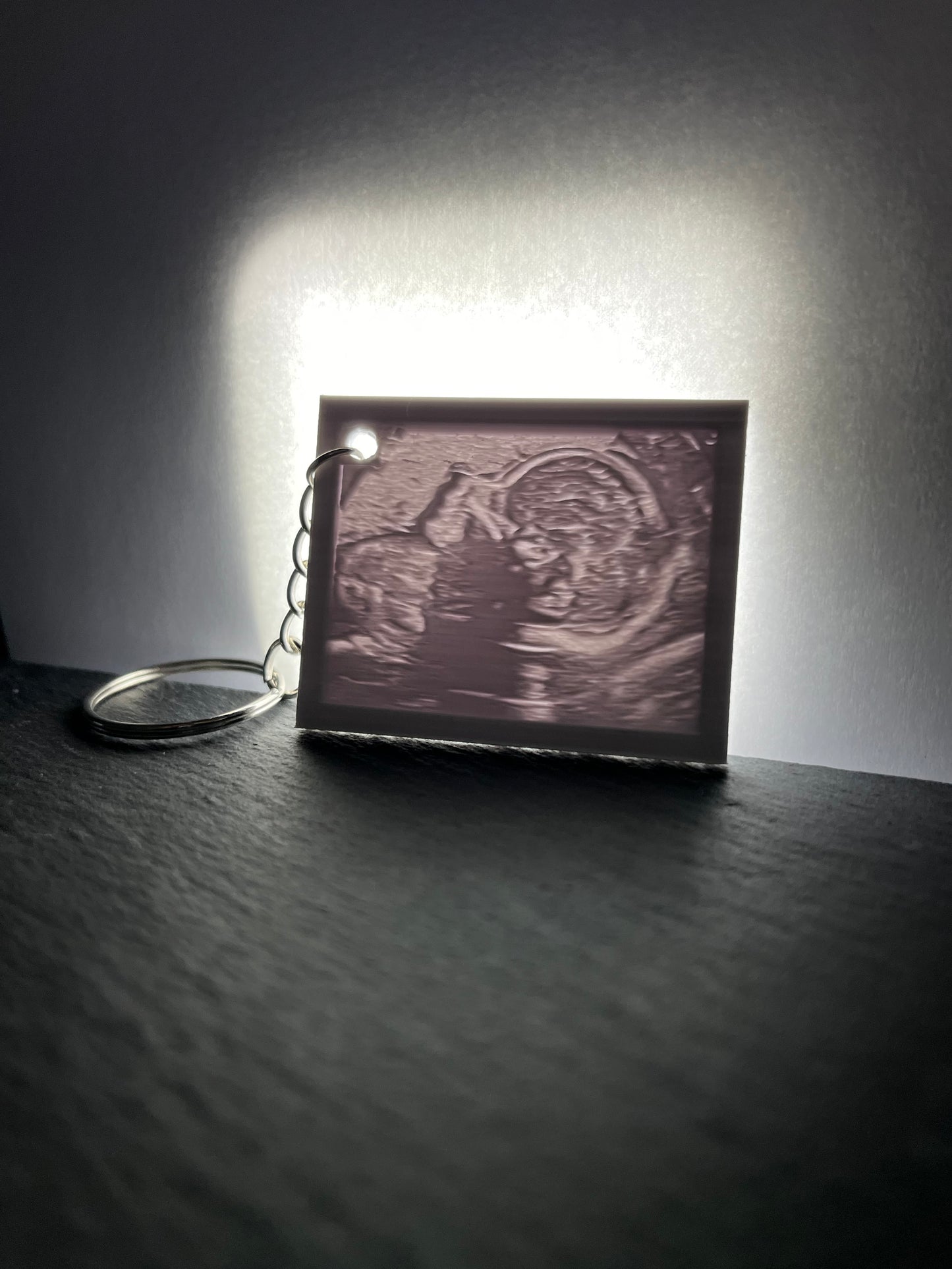 Baby Ultrasound Scan Photo Keyring