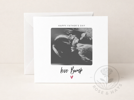 Custom Ultrasound Scan Father's Day Card
